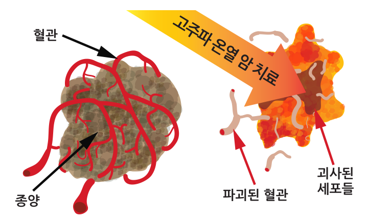 서브이미지